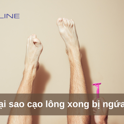 Why Does It Itch After Shaving?