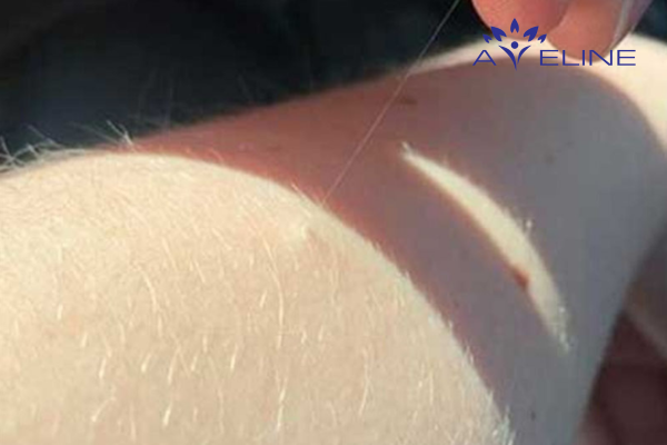 White arm hair in folk beliefs