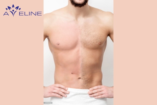 Adrenal Gland Disorders