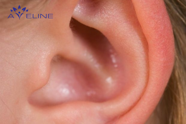 Causes of hair growth on the left outer ear