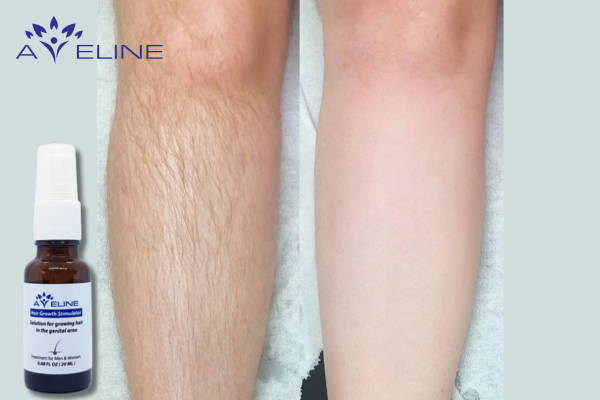 Feel More Confident with Your Leg Hair Thanks to Aveline Leg Hair Growth Serum