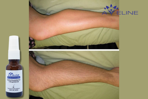 Embracing Leg Hair with Aveline Serum