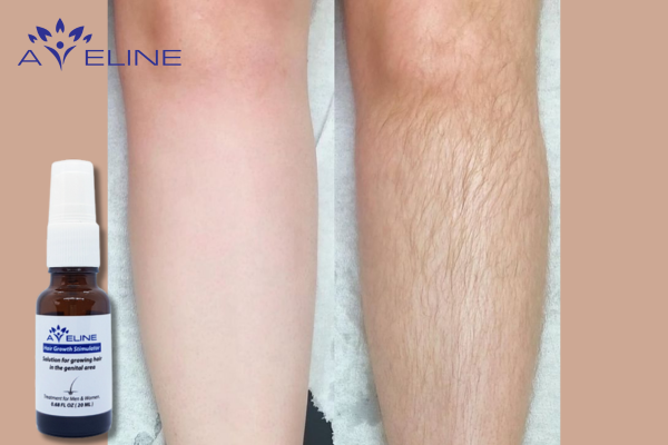 Growing Leg Hair Instead of Shaving with Aveline Serum