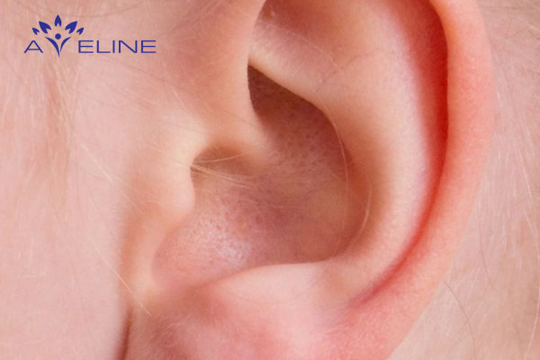 Hair on the ears is a normal part of the body
