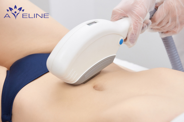 IPL Technology for Belly Hair Removal