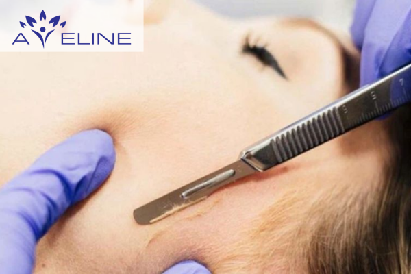 Is Facial Shaving Necessary