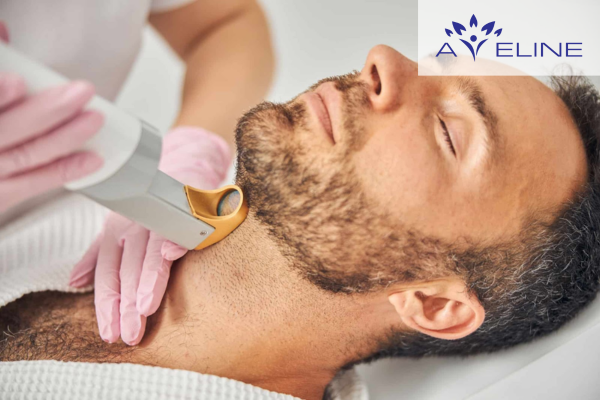 Laser hair removal