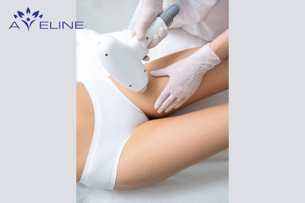 Laser Hair Removal