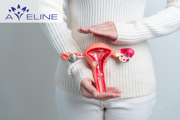 Polycystic Ovary Syndrome
