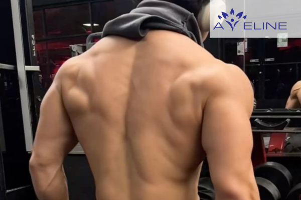 Should men remove back hair?