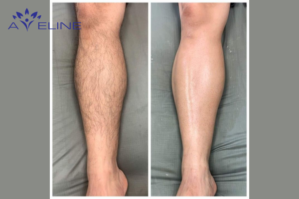 Benefits of Leg Hair