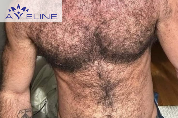 Benefits of Belly Hair for Men