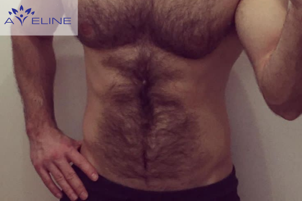 The Function of Belly Hair in Men