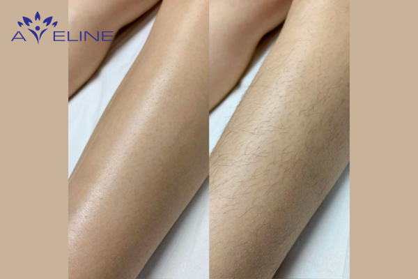 Disrupts the Skin’s Natural Balance