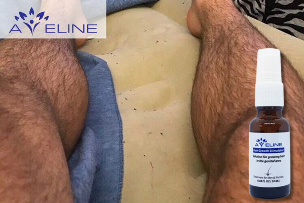 Important Notes When Using Leg Hair Growth Serum