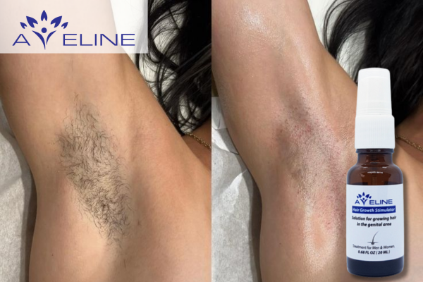 Aveline Underarm Hair Growth Serum