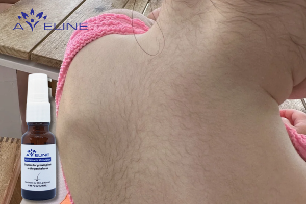 Using Aveline back hair growth serum