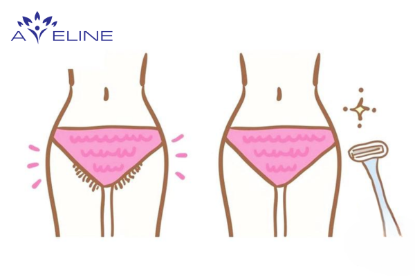 What Is Pubic Hair?