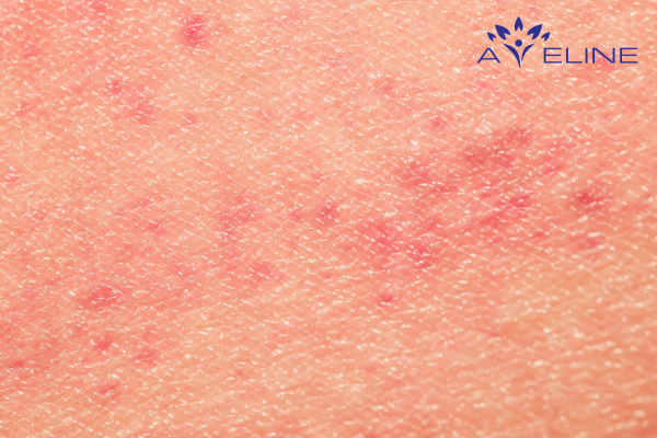 Causes of Skin Irritation After Shaving