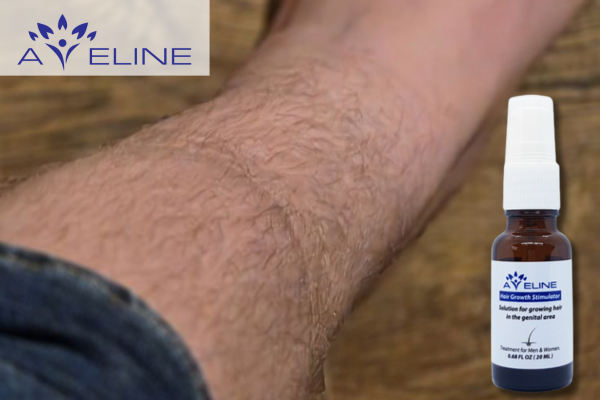 What Is Aveline Leg Hair Growth Serum?