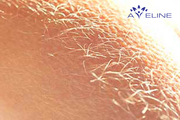 What is white arm hair?