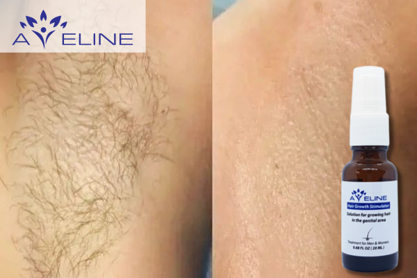 Who Should Use Aveline Underarm Hair Growth Serum?