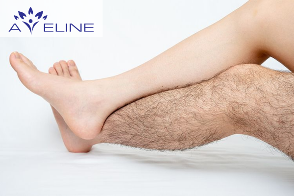 Why Do Many Men Have Little or No Leg Hair?