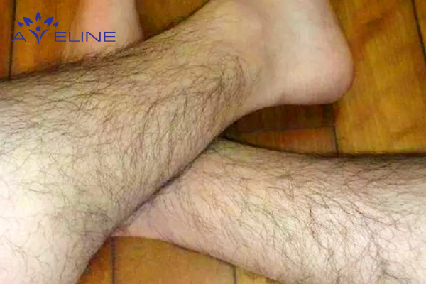 Reasons Why Men Have More Leg Hair